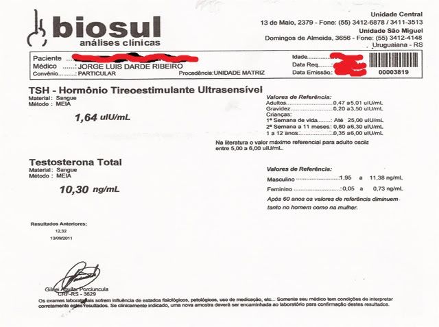 ExmedeTesto-PutaquePariu-Libidoestfudida.jpg